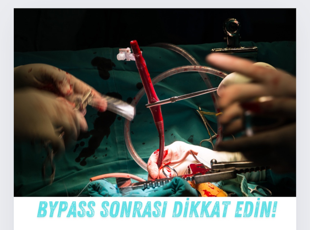 Koroner Bypass veya Stent Sonrası "Motoru Sıfırladık" Zannetmeyin!